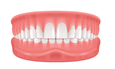 Deep-bite Deep-bite