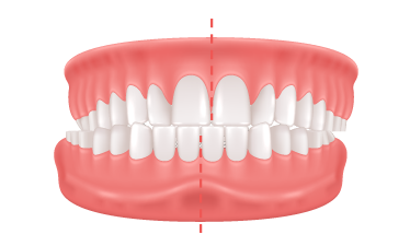 midline-shift midline-shift