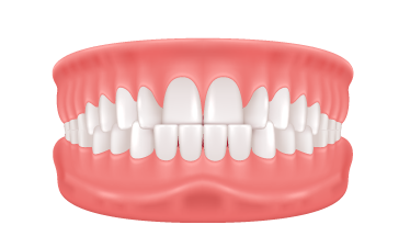 underbite underbite